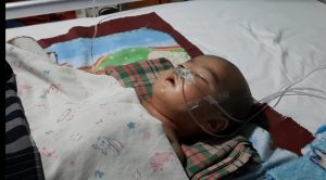 Tak Punya BPJS, Balita Malang Penderita Meningitis asal Sidimpuan ini Butuh Bantuan