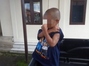 Saat Ditemukan, RH Anak yang Dibakar Orang Tua Asal Paluta Berdarah-darah dan Penuh Luka