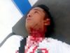Padahal Jualannya Belum Habis, Seorang Pedagang Bakso Keliling Diduga Dibacok Preman di Sidimpuan