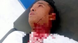 Padahal Jualannya Belum Habis, Seorang Pedagang Bakso Keliling Diduga Dibacok Preman di Sidimpuan