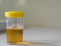 Jangan Anggap Sepele Busa di Urine, Bisa Jadi Sinyal Bahaya dari Ginjal